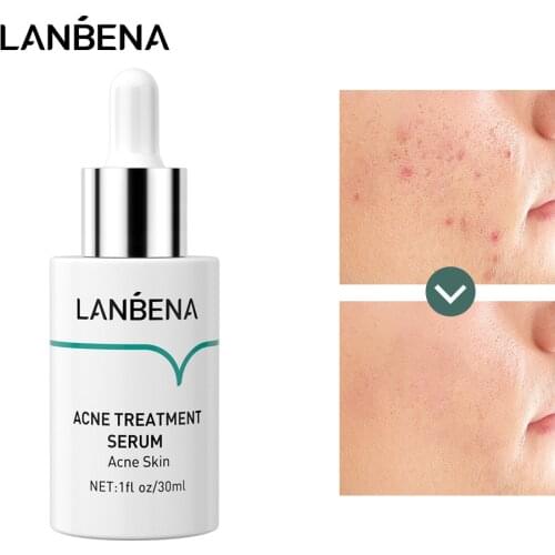 LANBENA Oligopeptide Anti Acne Solution Plant Extracts Acne Treatment Serum Reduce Mark Shrink Pores Deep Repair Skin Care 30ML