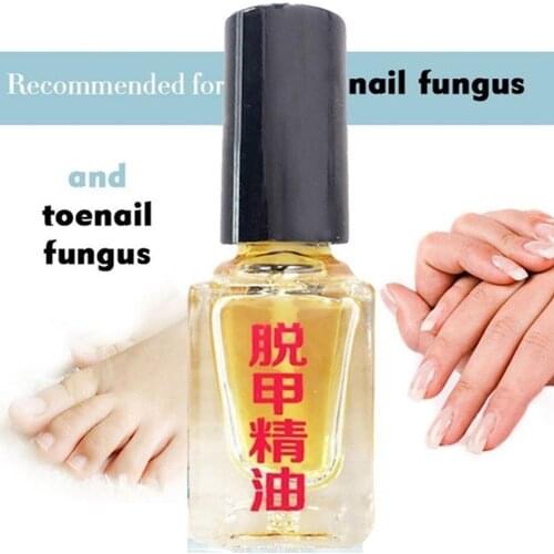 NEW 3 Days Effect Fungus Removal Essence Liquid Fungal Repair Nail Foot Treatment Bright Infection Nail Caring Anti Plaster P6O0