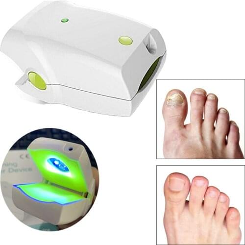 Ringworm of Nails Fingernail Fungus Onychomycosis Treatment Low Level Laser Therapy LLLT Home Use Stop Nail Fungal Infection