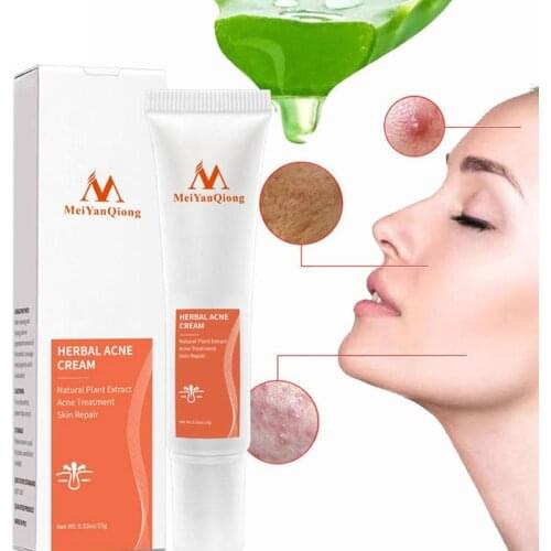 15ml Mei Yan Qiong Herbal Cleansing Acne Cream Removal Care Of Cleansing Acne Repair Acne Skin Acne Cream Treatment And P7V7
