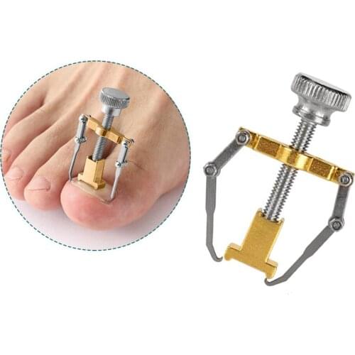 Ingrown Toenail Straightening Clip Treatment Paronychia Recover Tool Toe Corrector Ingrown Toenail Fixer for Nails Toe