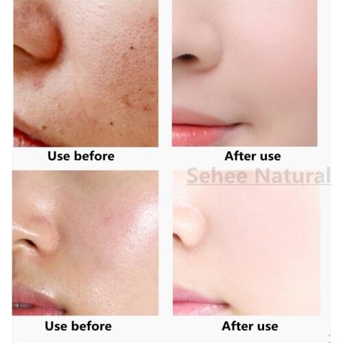 Vaseline Facial Massage Cream Hyaluronic Acid Deep Purification Body Face Massage cream 1000g Skin Care