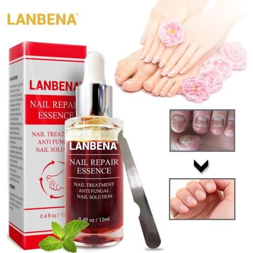 LANBENA Nail Repair Essence Serum Fungal Nail Treatment Remove Onychomycosis Toe Nourishing Brighten Hand Foot Skin Care 12ml