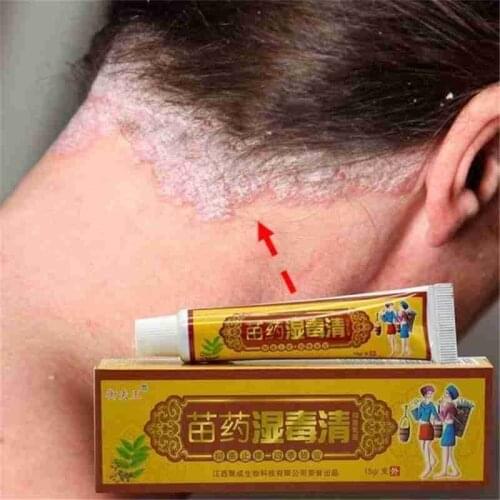 15G / Bottle Natural Herbal Material Psoriasis Creams and Eczema Psoriasis Ointment Skin Care Health Products Patches