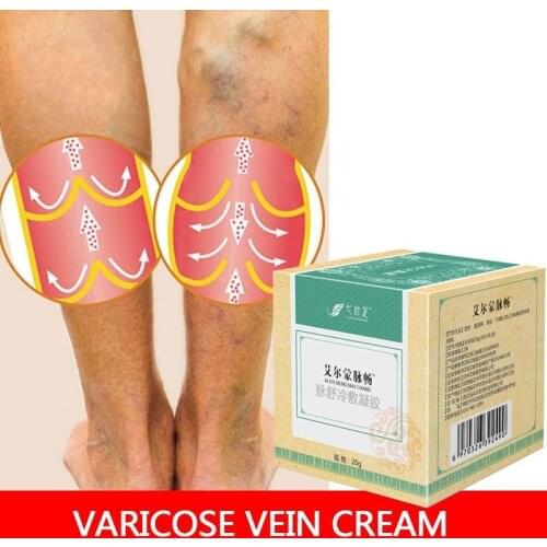 20g Varicose Vein Cream venous valves, enhance blood vessel elasticity, tighten and smooth legs, Chinese Herbal Medicine