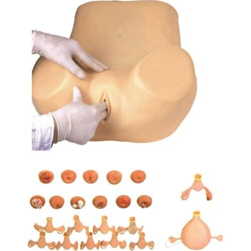 Advanced Gynecological Examination Training Model