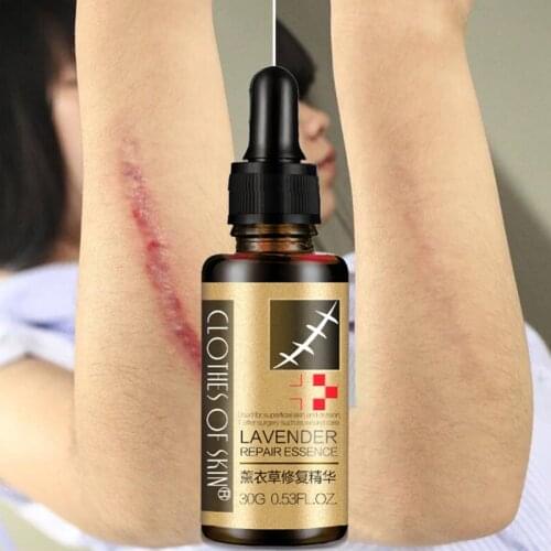 Lavender Massage Oil Stretch Marks Removal Scar Repair Remove Body Essential Oils Body Care Essence For Maternity Pregnant Women