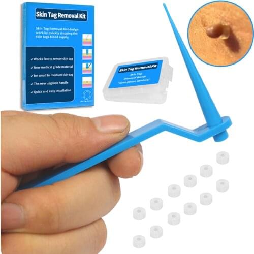 Medical Skin Tag Kill Skin Mole Wart Remover Micro Band Skin Tag Removal Kit With Cleansing Swabs Adult Mole Wart Face Care Tool