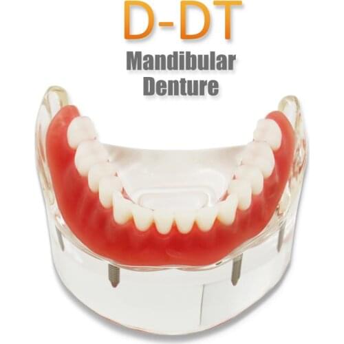 D-DT(Lower jaw) Dental Study Teaching Model Dental Impant Standard Model Removable Teeth ADULT Child Model Dentist Communicatio