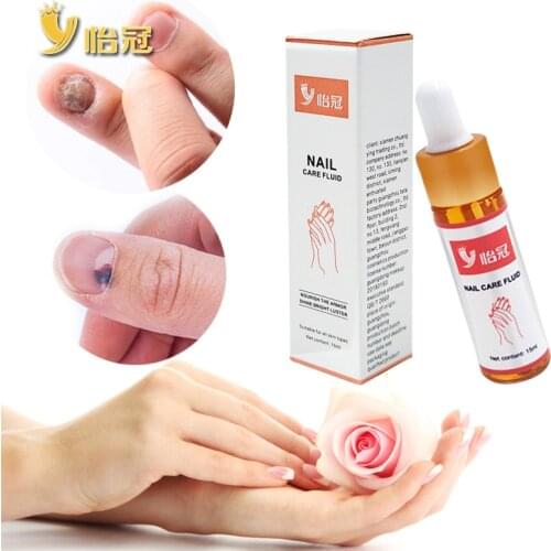 Y Nail Oils