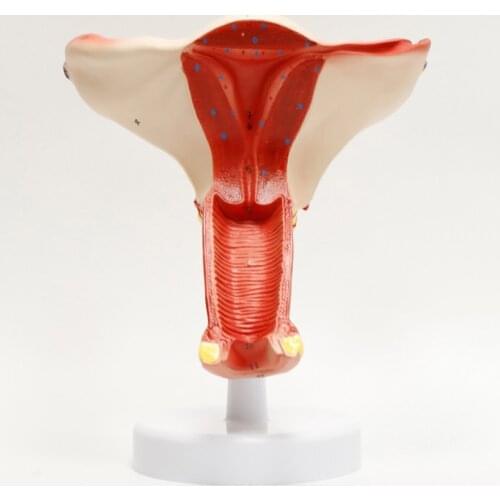 Female Uterus Ovary Anatomical Model Human Dissection Pathology Uterus Model Medical Anatomy Teaching Tools BIX-A1201
