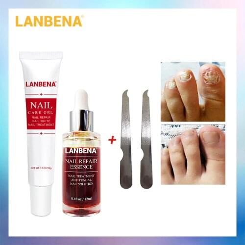 LANBENA Nail Repair Essence Serum+Nail Care Gel Nail Treatment Remove Onychomycosis Toe Nail Nourishing Hand And Foot Care 2PCS