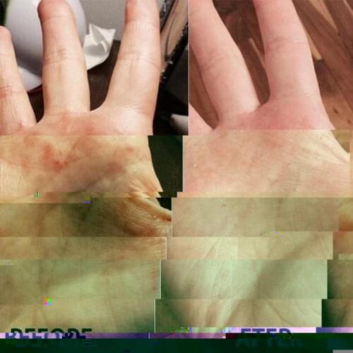 1pc Natural Chinese Herbs Cream Analgesic Cream Treat Rheumatoid Arthritis\\joint Relief Pain Pain\\back Analgesic Ointment N9Y9