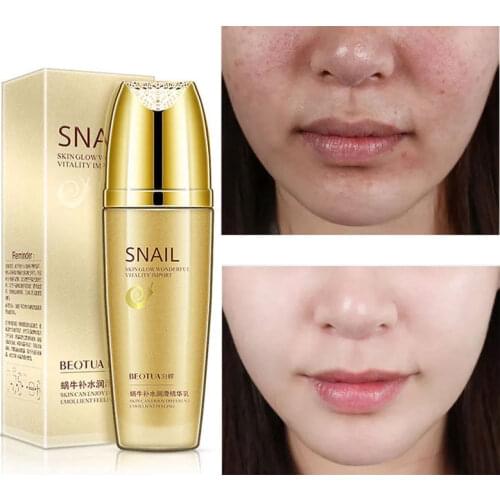 Snail Serum Lotion Moisturizing Oil Control Whitening Anti-Wrinkle Anti-Aging Nourish Allantoin Hyaluronic Acid Skin Care 100ml