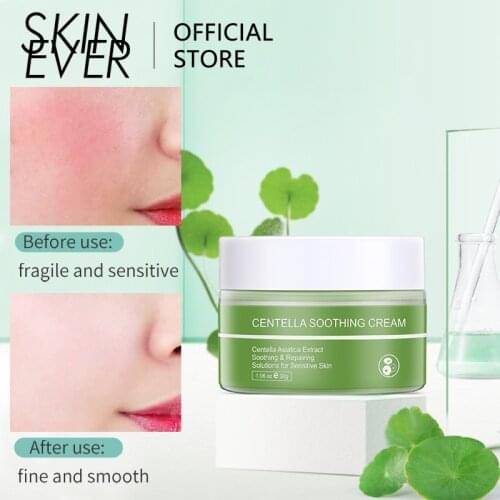 SKINEVER Centella Facial Cream Hydrating Moisturizing Oil Control Anti Aging Wrinkle Whitening Smooth Ointment Skin Care TSLM2