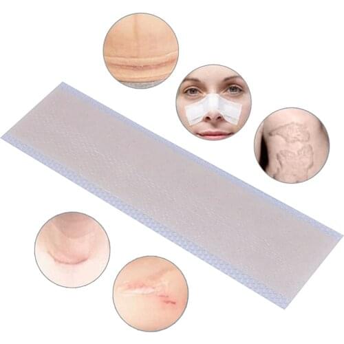 1pcs Silicone Scar Removal Patch Skin Repair Scar Removal Therapy Patch for Acne Scar Treatment Remove Trauma Burn Scar Sheet