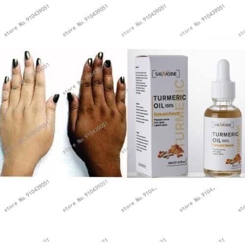 Turmeric Lemon Oil Skin Glow To Lightening Acne Dark Patches, Acne Bright Skin Dark Spot Corrector Face Whitening Serum