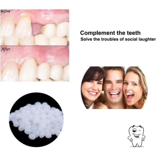 10/15/25/50gTemporary Tooth Filling Missing Teeth Whitening Teeth Filling Material GapsTeeth Solid Glue Denture Adhesive