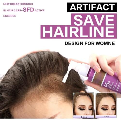 Anti Hair Loss Essence Hair Growth Treatment Oil Fast Thick Hair Growth Spray Eyebrows Natural Healthy Hair Tonic