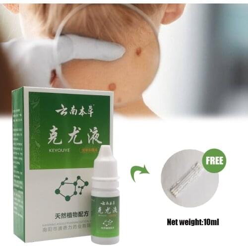 Wart Remover China Medicine Repair Mole Flat Treatment Bacteriostatic Foot Corn Skin Tag Mole Infectious Liquid Body Health Care