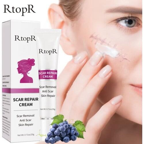 RtopR Acne Scar Stretch Marks Remover Cream Skin Repair Face Cream Acne Spots Acne Treatment Blackhead Whitening Cream Skin Care