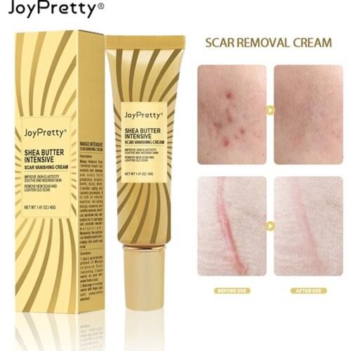 JoyPretty Mango Removal Scar Cream Repair Burn Scars Promote Cell Regeneration Cream Moisturize Enhance Elasticity Skin Care