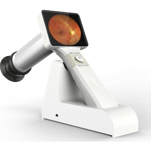 Ophthalmic instruments digital fundus camera China ophthalmic optical equipment fundus camera Portable retinal camera