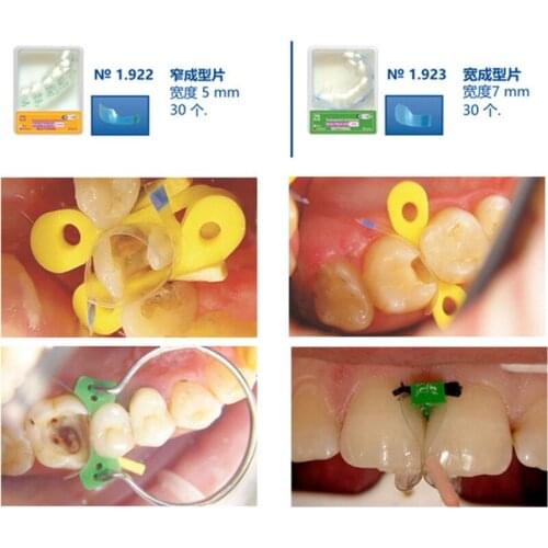 7mm Dental Transparent Matrices 5mm Sectional Contoured Dental Matrices Polyester Matrix Pre-shaped Dental Restoration Matrices