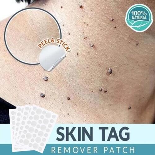 24/36/72 Pcs Acne Patch Treatment Skin Care Face Pimple Master Remover Sticker Patch Facial Cover Patches Skin Tag