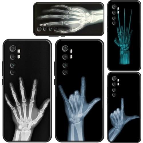 X-ray Hand Bones Case For POCO F3 X3 M3 Pro Phone Cover For Xiaomi Mi 11 Ultra 9T 10T Pro Mi Note 10 Lite