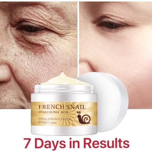 Facial cream whitening snail cream aloe vera anti-aging anti-wrinkle nourishing acne treatment moisturizing repair skin