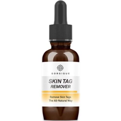 Effective Whitening Freckle Cream Remove Melasma Acne Skin Pigment Gel Spots Moisturizing Melanin Pigmentation Dark Care Sp D8X0