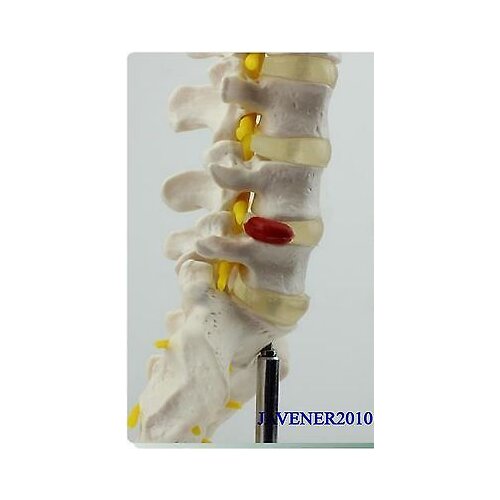 1:1 Human Anatomical Lumbar Vertebra Medical Model Flexible +Stand