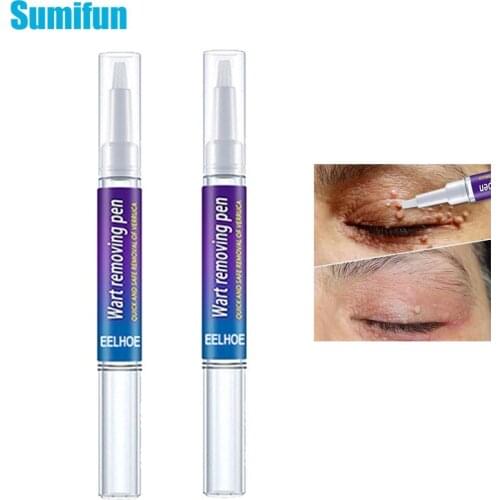 1 pc Wart Liquid Skin Tag Removal Pen Facial Body Warts Effective Treatment Flat Warts Filiform Mole Herbal Extracts Skin Care