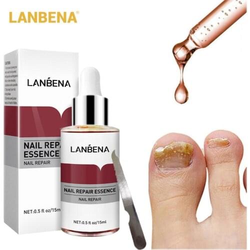 LANBENA Nail Fungal Treatment Feet Care Essence Onychomycosis Paronychia Anti-Fungal Infection Removal Gel Toe Foot Repair Care