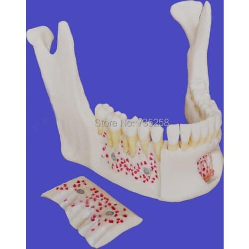 Senior 1:1 Simulation Model of Mandible,High Copy of Neurovascular Mandibular Teeth Model