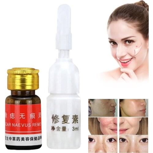 Mole Skin Tag Removal Solution 100% Remover Skin Tags Warts Moles Repair Solution EF