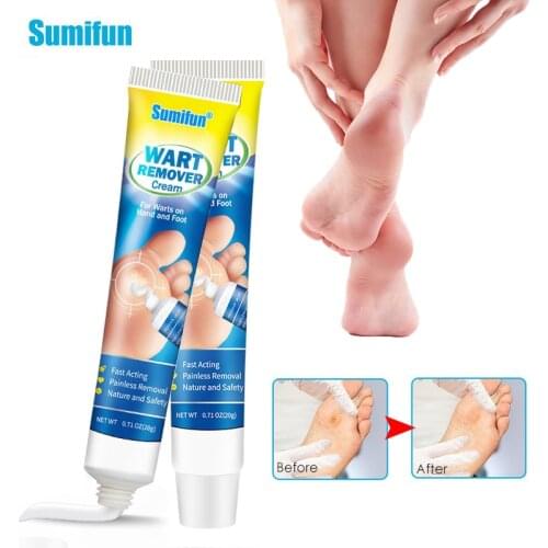 1Pcs 20g Sumifun Wart Cream Remove Foot Corn Mole Skin Tag Sarcoma Calluses Ointment Antibacterial Herbal Care Medical Plaster