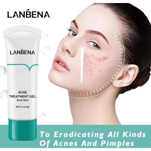 LANBENA Acne Treatment Whitening Cream Blackhead Repair Gel Oil Control Shrink Pore Scars Moisturizing Skin Skin Care