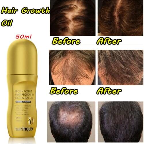 Lealia Hair Loss Remedies