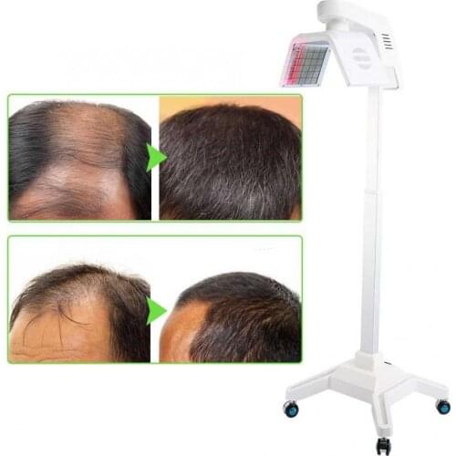 Health nautral 650NM Hair Loss Treatment Generator Instrument Therapy Lamp Growth red Laser Machine