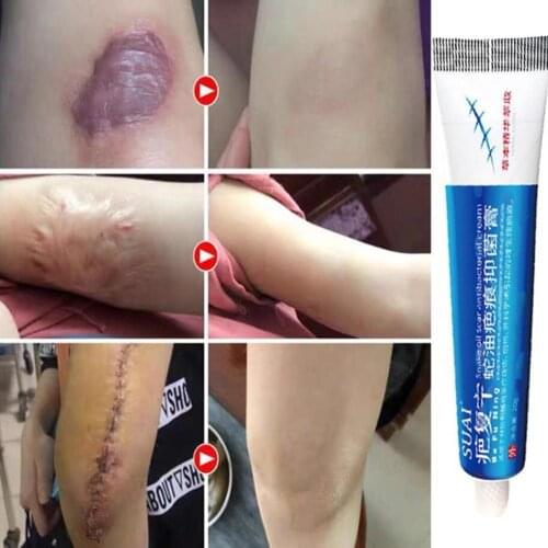 20g Scars Removal Repair Cream Scald Burn Papules Eczema Ointment Relieves Skin Itching Psoriasis Derma Treatment Body Skin Care