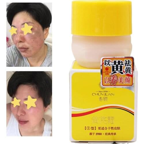 Chinese Medicine Astragalus 20% cream Whitening Remove Dark Spots Face Cream Repair Fade Freckls Melanin Remover Brighten Skin