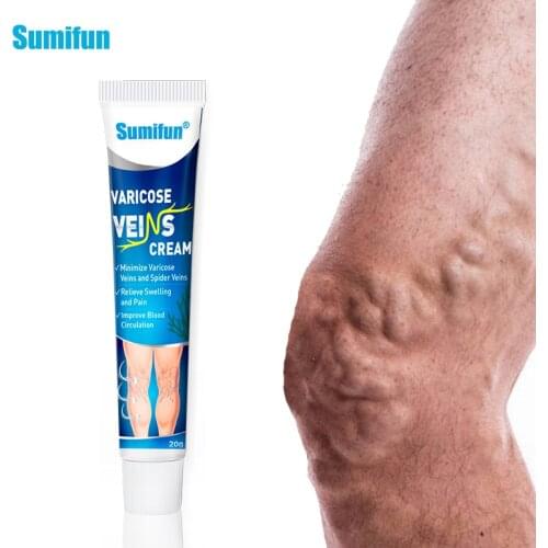 New Sumifun 1Pcs 20g Varicose Vein Ointment Treatment Vasculitis Blood Vessel Swelling Spider Pain Relief Cream Health Care