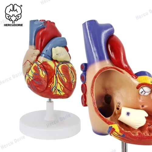 2X Enlarged Human Heart Anatomical Model,Anatomically Accurate Heart Model Human Skeleton Anatomy for Science Classroom Study