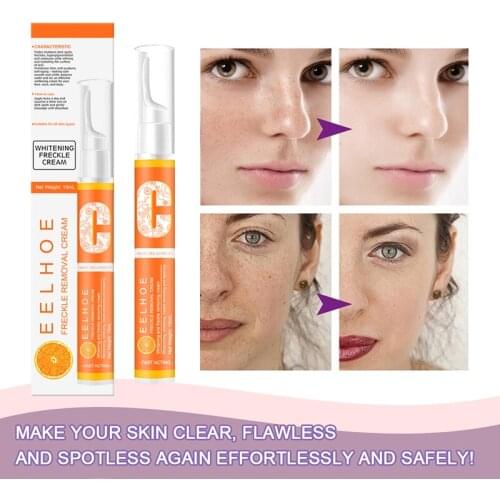Instant Blemish Removal Gel VC Whitening Freckle Cream Pen Whiten Remove Freckle Pigmented Melanin Spots Face Skin Care TSLM1