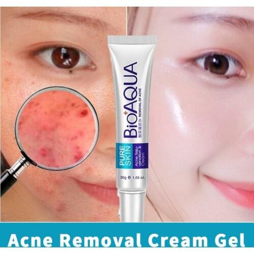 BIOAQUA Acne Removal Cream Gel Anti-Acne Scar Treatment Skin Care Face Whitening Cream Moisturizing Oil Control Acne Remover 30g