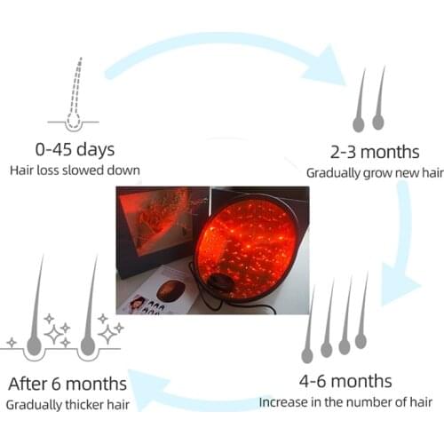 HairPro Laser Hair Growth Cap Men and Women Laser Hair Loss Treatment for Full Scalp Treatment to Reverse Thinning Hair
