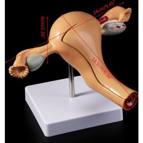 Human Pathological Uterus Ovary Model Anatomical Anatomy Disease Pathology Medical Lesion For Teaching