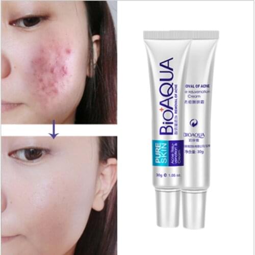 BIOAQUA Brand Skin Care Face Acne Treatment Acne Scars Cream Anti Acne Removal Gel Whitening Moisturizing Cream 30g